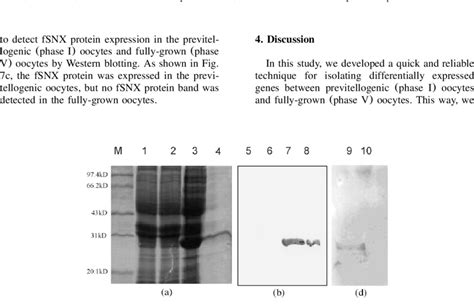 Production Of Polyclonal Antibody Against FSNX Protein And Recognition