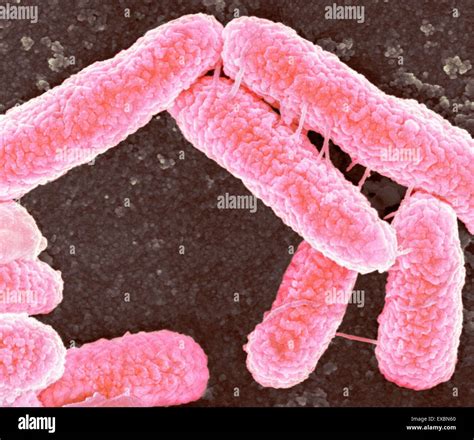 Coloured Scanning Electron Micrograph Sem Of Escherichia Coli Bacteria The Tubes Connecting