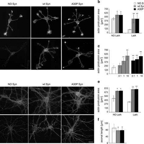 Actin Cytoskeleton Displays Alterations In Fibroblasts From Pd Affected