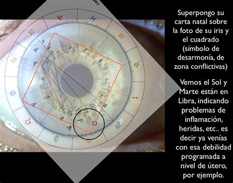 Iridología en valencia: ESTUDIO DE UN IRIS (junio 2014). (resumido)