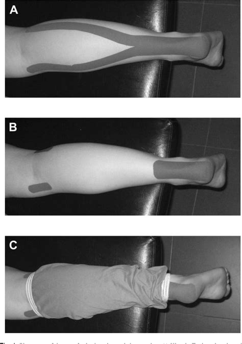 Figure 1 From The Effects Of Kinesio Taping On Muscle Tone In Healthy