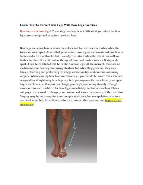 Learn How To Correct Bow Legs With Bow Legs Exercises