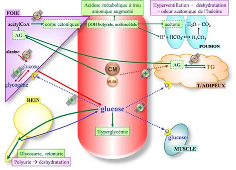 ACIDOCETOSE CHEZ LE DIABETIQUE