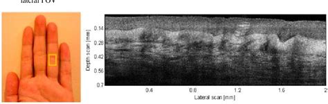 Figure 1 From Gabor Based Fusion Technique For Optical Coherence