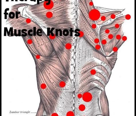 Trigger Point Therapy Massage Technique Physiotherapy Uses