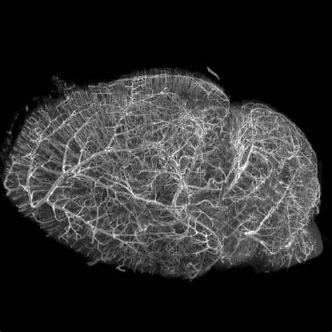 Looking Deep Into Chemically Cleared Brain Thick Tissues