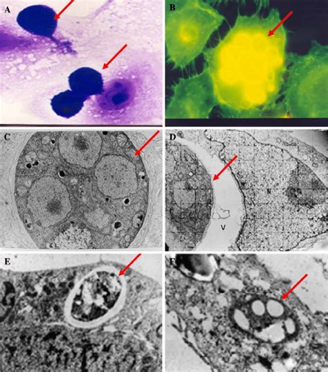 Adhesion To And Invasion Of Vero Cells By P Brasiliensis A Optical