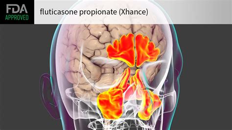 First Treatment Approved For Chronic Rhinosinusitis Without Nasal