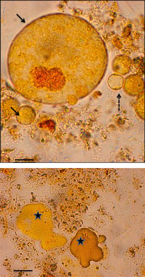 Morphological Forms Of Blastocystis Sp In Xenic Culture Stained With Download Scientific