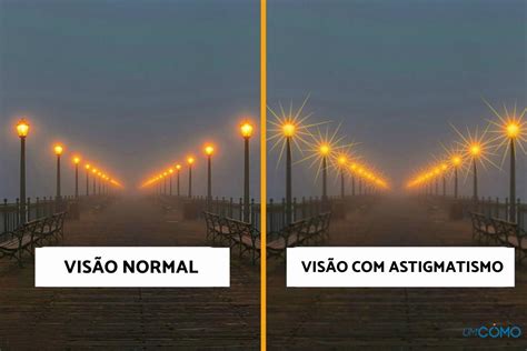 Como A Vis O De Quem Tem Astigmatismo Causas Sintomas E Tratamento