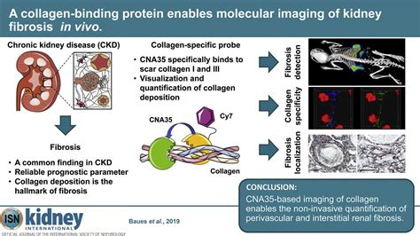 ERA European Renal Association On Twitter CNA35 Collagen Binding