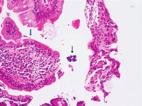 Photomicrograph Showing Both Sarcina Thin Black Arrow And Giardia Download Scientific Diagram