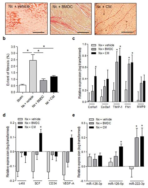 Interstitial Fibrosis Extracellular Matrix Remodeling And Expression