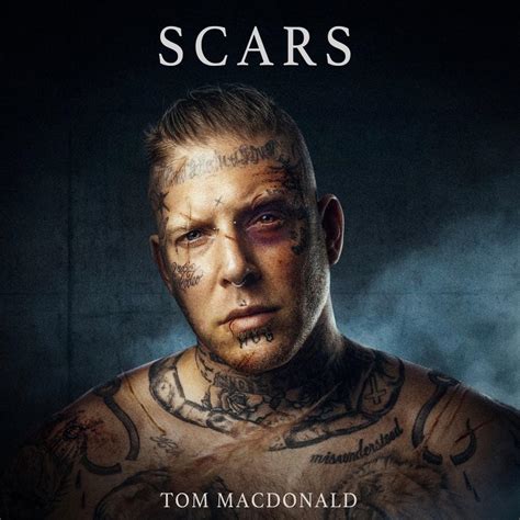 Tom Macdonald Scars Lyrics Genius Lyrics