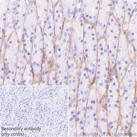 Recombinant Anti Laminin Gamma Antibody Epr Bsa And Azide