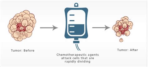 How Does Chemotherapy Work 5 Ways To Kill Cancer Cells