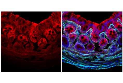 Galectin 3 LGALS3 E7B6R Rabbit MAb BSA And Azide Free Cell