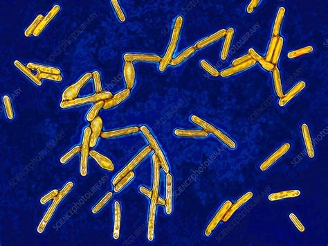 Clostridium Botulinum Color