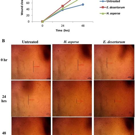 Scratch Wound Healing Assay A Percentage Of Wound Closure At 0 24 Download Scientific