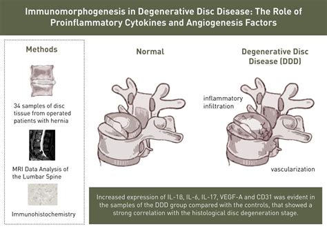 Biomedicines Free Full Text Immunomorphogenesis In Degenerative