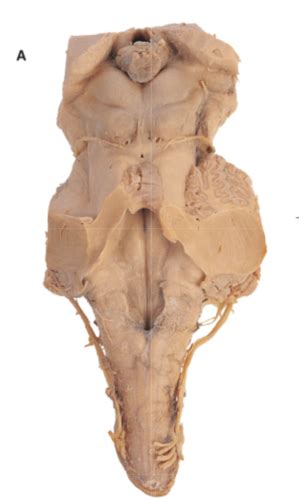 Brainstem Anatomy Flashcards Quizlet