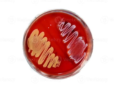 colonia bacteriana en agar sangre en placa petri. medios de cultivo