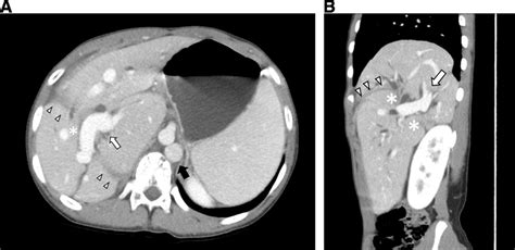 Ab Axial And Sagittal Reformatted Image Of Contrast Enhanced Ct Download Scientific Diagram