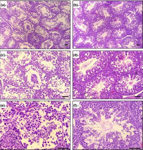 Photomicrograph Of Histological Section Of Testicular Parenchyma Of