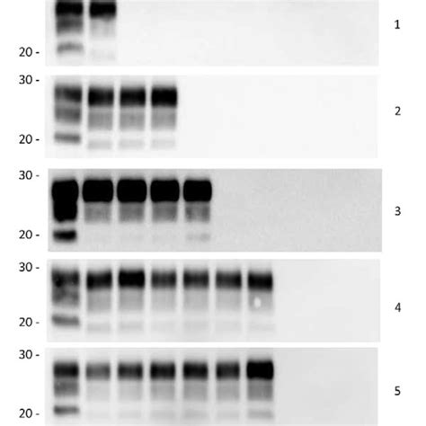 Protein Misfolding Cyclic Amplification Pmca Of Peripheral Tissues