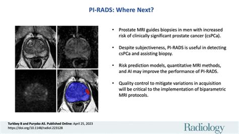 Pi Rads Where Next Radiology