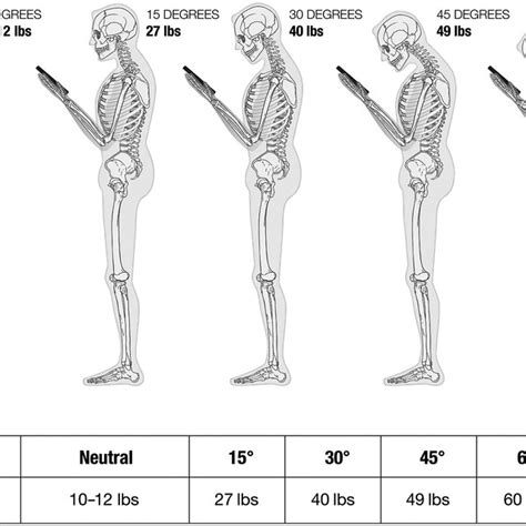 illustration of forces applied to cervical cord during flexion ...