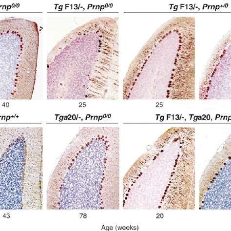 Time Course Of Purkinje Cell Degeneration In Z Rich I Prnp O O Mice