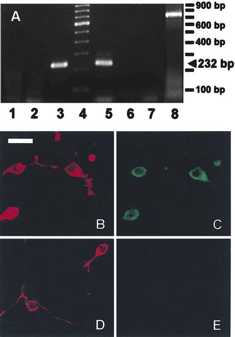 Ccr1 Is Expressed In Oligodendroglial Cells A Rt Pcr For Ccr1 And