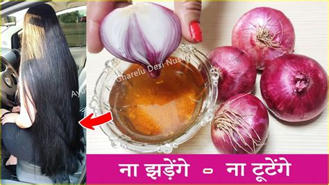 ONION HAIR OIL for faster hair growth Balo ke liye Pyaj ka tel पयज