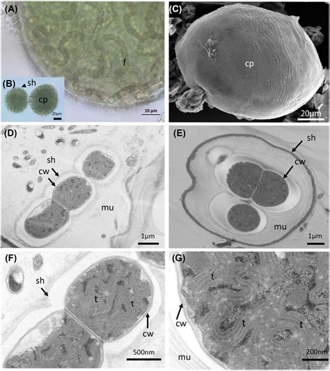 Light Microscopy A And B SEM C And TEM D G Micrographs Of Nostoc