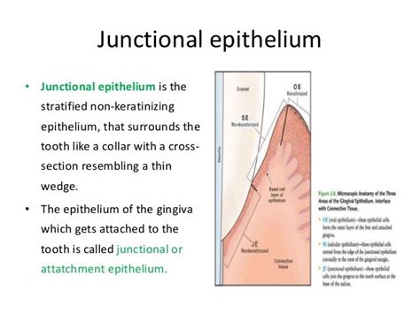 486 junctional epithelium