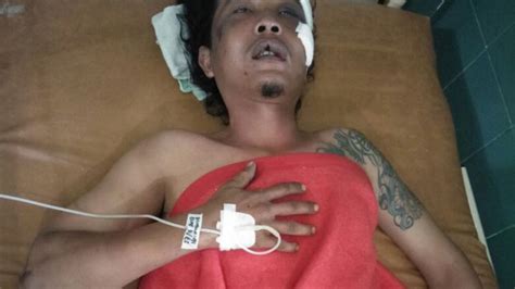 Ibey Selamat Meski Kena Bacok 25 Kali Oleh Dua Orang Preman Tribun