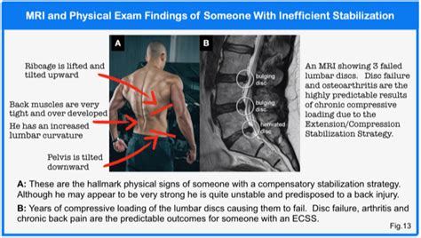 Core Stability Explained Inside Out Part 3 Drmorrisgasparin