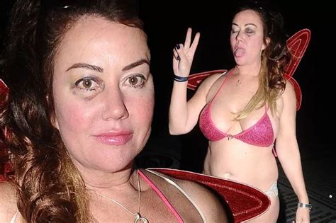 Rough Night Lisa Appleton Has A BLACK EYE As She Leaves Club In A Pink Sequin Bikini And