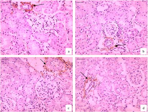 Collagen III Immunohistochemical Staining Of Control C And Zinc