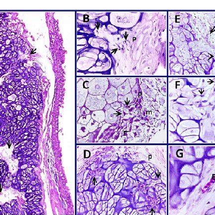 Mesenchymal Cells Penetration In The Supporting Elastic Cartilage Of