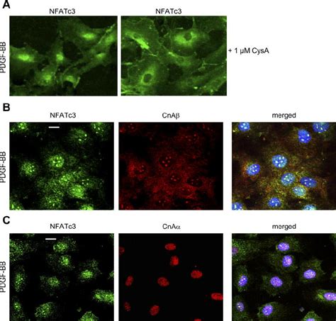 Nuclear Localization Of Nfatc Is Dependent On Calcineurin