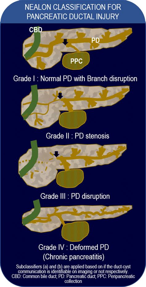 Abbreviated Nealon Classification For Pancreatic Ductal Injury