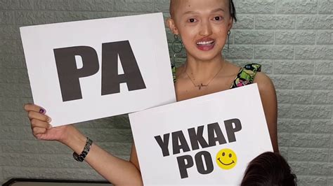 Yayakap Ka Ba Sa Babaeng Kalbo Will You Hug A Bald Lady Youtube