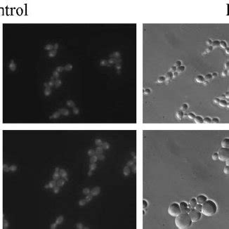 Tetracycline Induced Expression Of The Dominant Negative CDC42 D118A