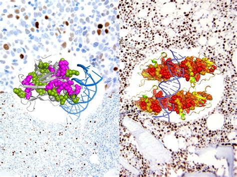 All TP53 mutations are NOT equal: Does the "deleterious effect" of the TP53 mutation affect the ...