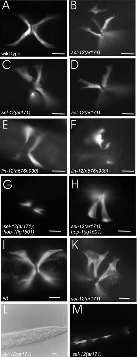 Vulva Muscle Defects In Presenilin And Lin 12notch Mutants Visualised