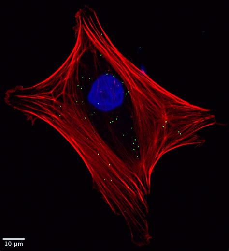 Osteoblast Derived Vesicles Are Internalised By Mesenchymal Stem Cells