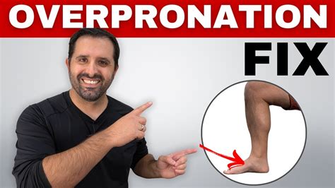 4 Exercises To Correct Overpronation In Runners To Prevent Injury Youtube