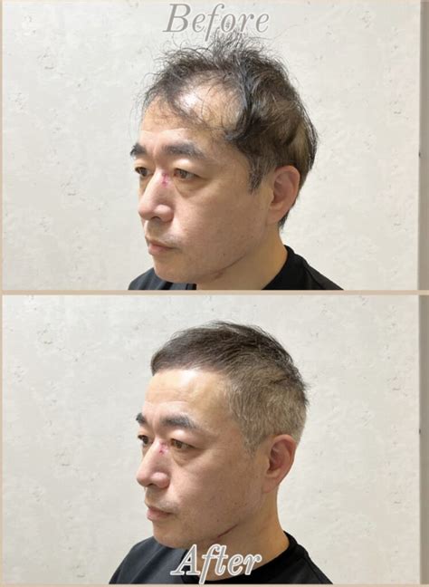 50代の薄毛をカバーするヘアスタイル Relive 薄毛に悩む男性のための完全個室美容室